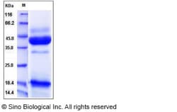 Sino Biological Mouse INHBA Protein 50ug (Sino Biological), Quantity: Each