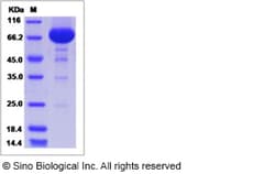 Sino Biological Rat IL12B Protein 50ug (Sino Biological), Quantity: Each