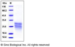 Sino Biological Recombinant Human Cripto Protein (His Tag), Quantity: Each