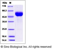 Sino Biological Cynomolgus FAS Protein 100ug (Sino Biological), Quantity: