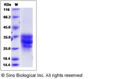 Sino Biological Cynomolgus FAS Protein 100ug (Sino Biological), Quantity: