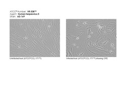ATCC&nbsp;Human herpesvirus 5; Human cytomegalovirus; Strain: AD-169