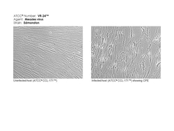 ATCC Measles virus strain Edmonston (ATCC VR-24 ), Quantity: Each of 1
