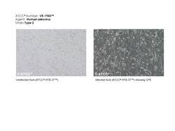 ATCC Human astrovirus (HAstV) Type 2, ATCC VR-1943 - Frozen research strain,