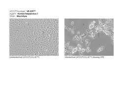ATCC Human herpesvirus 1; Herpes simplex virus 1; Strain: MacIntyre, Quantity: