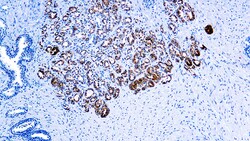 Diagnostic Biosystems P504S/ALPHA-METHYLACYL-COA p504S/Alpha-Methylacyl-CoA