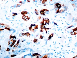 Diagnostic Biosystems MAMMAGLOBIN A Mammaglobin A, Quantity: Each of 1