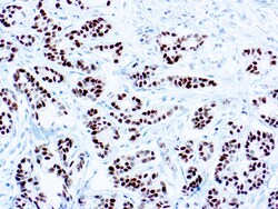 Diagnostic Biosystems ESTROGEN RECEPTOR ER Estrogen Receptor (ER) - SP1,