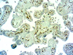Diagnostic Biosystems CASPASE 1 Caspase 1/Interleukin-1-β Converting Enzyme,