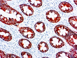Diagnostic Biosystems CYTOKERATIN 8 Cytokeratin 8, Low Molecular Weight,