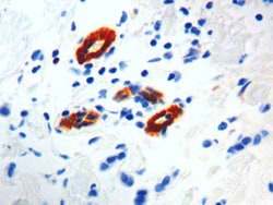 Diagnostic Biosystems TRANSGLUTAMINASE II Transglutaminase II, Quantity: