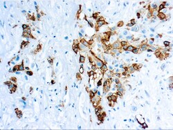 Diagnostic Biosystems MESOTHELIN Mesothelin, Quantity: Each of 1