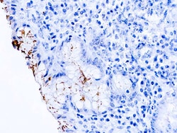 Diagnostic Biosystems HELICOBACTER PYLORI Helicobacter Pylori Antibody,