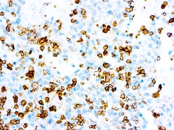 Diagnostic Biosystems GLUT-1 GLUT-1, Quantity: Each of 1