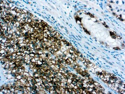 Diagnostic Biosystems PLAP Placental Alkaline Phosphatase (PLAP) (SP15),