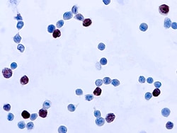 Diagnostic Biosystems ADENOVIRUS Adenovirus