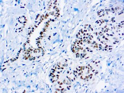 Diagnostic Biosystems WILMS TUMOR 1 PROTEIN WT1 Wilm’s Tumor 1, WT1, Quantity: