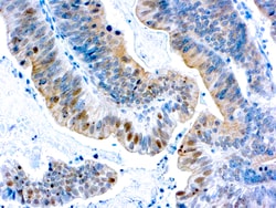 Diagnostic Biosystems BRCA1 BRCA1, Quantity: Each of 1
