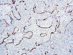 Diagnostic Biosystems CYTOKERATIN AE1 AE3 Cytokeratin AE1/AE3, Quantity: