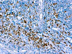 Diagnostic Biosystems CASPASE 3 Caspase 3/CPP32