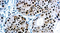 Diagnostic Biosystems P27 KIP1 p27KIP1, Mitotic Inhibitor / Suppressor