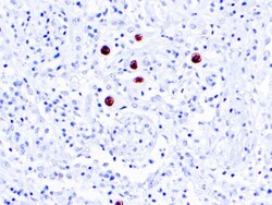 Diagnostic Biosystems CMV COCKTAIL Cytomegalovirus (CMV Cocktail)