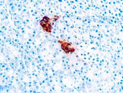 Diagnostic Biosystems PANCREATIC POLYPEPTIDE Pancreatic Polypeptide, Quantity: