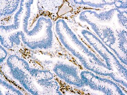 Diagnostic Biosystems CD31 PECAM-1 CD31, Endothelial Cell, Quantity: Each