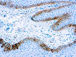 Diagnostic Biosystems CYTOKERATIN 15 Cytokeratin 15, Quantity: Each of
