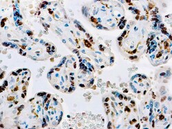 Diagnostic Biosystems FACTOR XIIIA Factor XIII-A