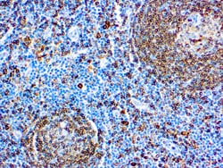 Diagnostic Biosystems CD74 B-CELL CD74, Lymphoid Marker, Quantity: Each