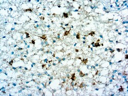 Diagnostic Biosystems ANTI ISOCITRATE DEHYDROGENENAS Anti-Isocitrate Dehydrogenenase