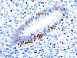 Diagnostic Biosystems E2F-1 TRANSCRIPTION FACTOR E2F-1 Transcription Factor,