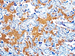 Diagnostic Biosystems GLYCOPHORIN A Glycophorin A, Quantity: Each of 1