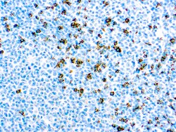 Diagnostic Biosystems CD8 T CELL CD8 (SP16), Quantity: Each of 1
