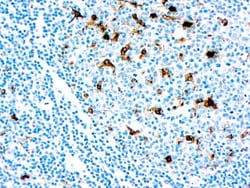 Diagnostic Biosystems LYSOZYME Lysozyme
