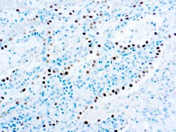 Diagnostic Biosystems TTF-1 Thyroid Transcription Factor-1, TTF-1, Thyroid