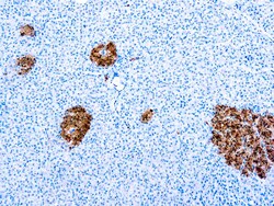 Diagnostic Biosystems NEURON SPECIFIC ENOLASE Neuron Specific Enolase,