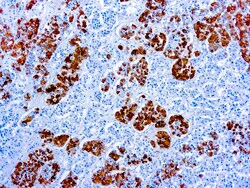 Diagnostic Biosystems ADRENOCORTICOTROPIC HORMONE Adrenocorticotropic Hormone