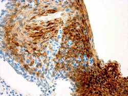 Diagnostic Biosystems CYTOKERATIN 13 Cytokeratin 13, Quantity: Each of