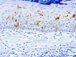 Diagnostic Biosystems CD1A CORTICAL THYMOCYTES CD1a Cortical Thymocytes