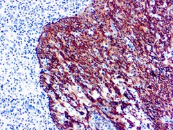 Diagnostic Biosystems CYTOKERATIN PAN, Quantity: Each of 1