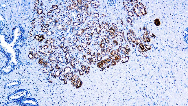 Diagnostic Biosystems P504S/ALPHA-METHYLACYL-COA RACEMASE (AMACR ...