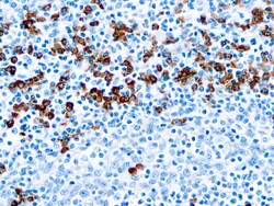 Diagnostic Biosystems IGG IgG, Quantity: Each of 1