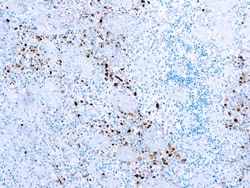 Diagnostic Biosystems HSV I Herpes Simplex Virus Type I (HSV1) - RUO