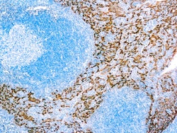 Diagnostic Biosystems CYTOKERATIN 5AND14 Cytokeratin 5/14, Quantity: Each