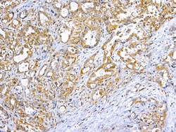 Diagnostic Biosystems TNF-ALPHA TNF-Alpha (Tumor Necrosis Factor alpha),