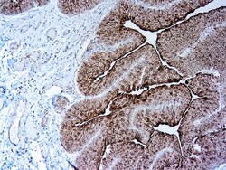Diagnostic Biosystems UROPLAKIN III AU1 Uroplakin III