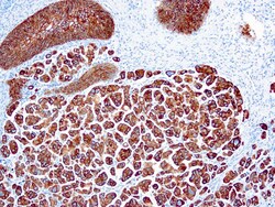 Diagnostic Biosystems CYTOKERATIN 7 Cytokeratin 7 (LP1K), Quantity: Each