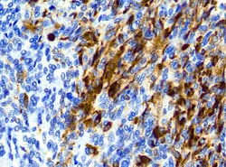 Diagnostic Biosystems CALRETININ H-5 CALRETININ H-5, Quantity: Each of